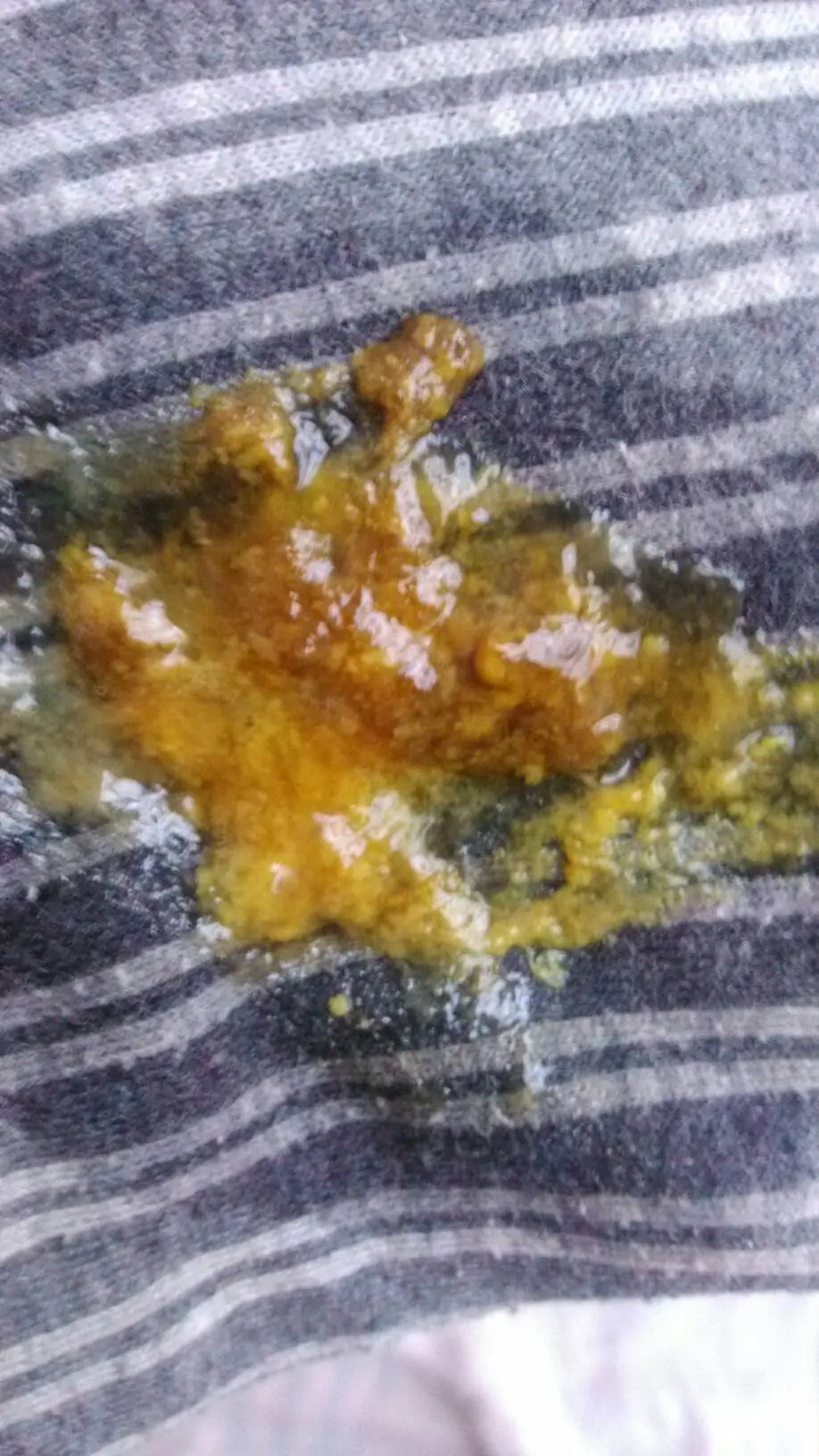 大便肚子拉黑是肠癌吗_拉肚子 为什么大便是黑的_大便肚子拉黑是怎么回事