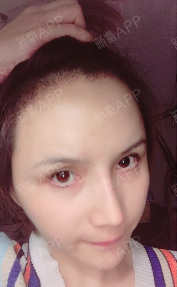 修发际线，美图秀秀帮你搞定